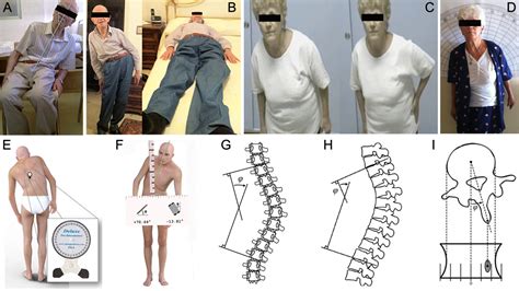 dementia posture leaning forward