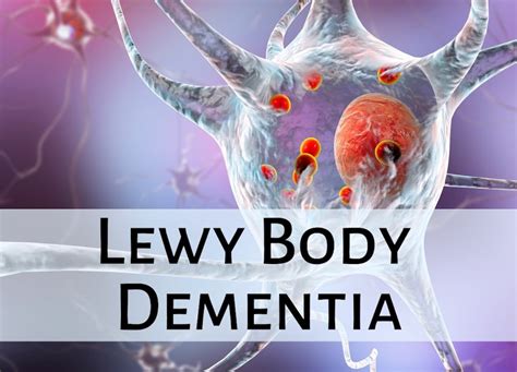 dementia w lewy bodies