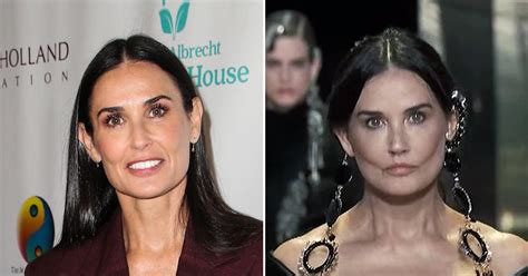 demi moore buccal fat removal
