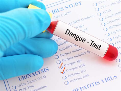dengue fever laboratory test