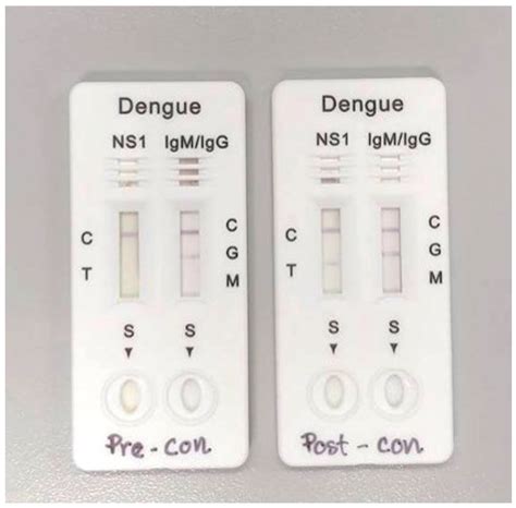 dengue fever ns1 antigen test