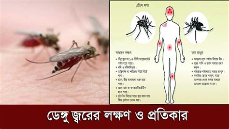 dengue fever symptoms bangla