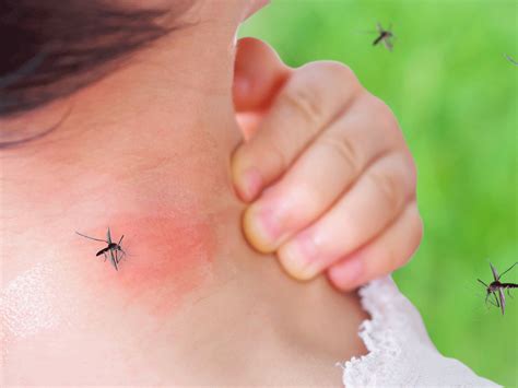 dengue mosquito bite image