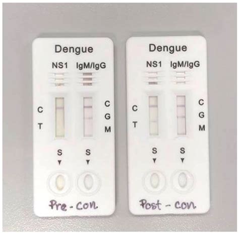 dengue ns1 antigen test kit