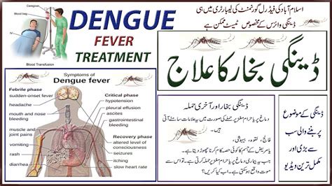 dengue symptoms in urdu