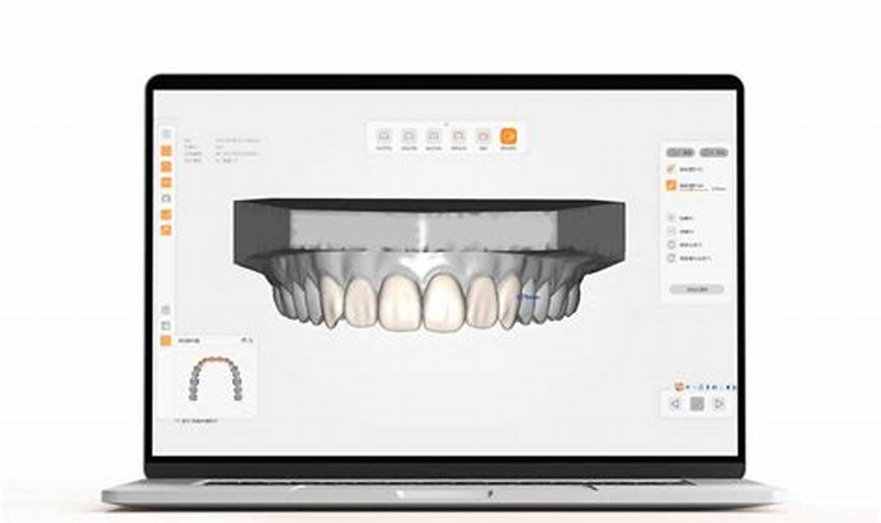 Unlock Dental Precision: The Ultimate Guide to Dental Laboratory Software