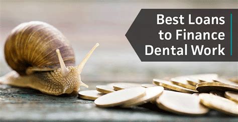 Finding Dental Care With Bad Credit? Dental financing, Bad credit, Dental care