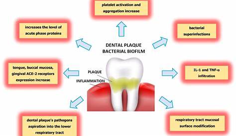 Dental Plaque Formation Steps Step Of Tooth Decay . Healthy Tooth, Forming