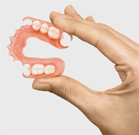 Dental Appliance Prosthesis