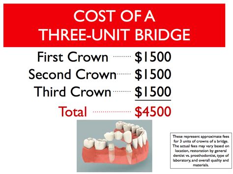 dental bridge cost estimate malaysia