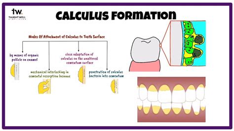 Dental Calculus Matrix