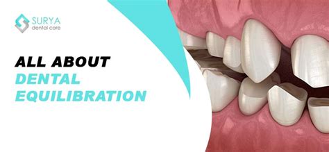 Dental Code For Equilibration