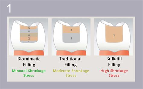 Dental Composite Layer