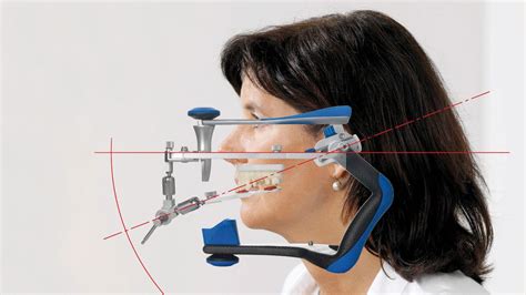 Dental Facebow Transfer
