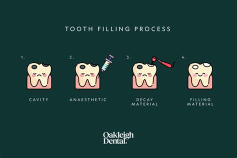 dental filling process
