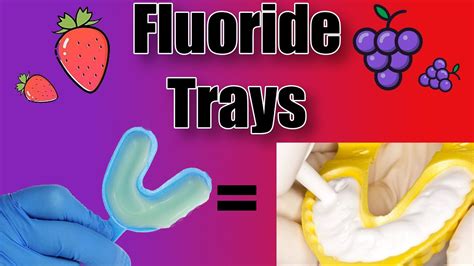 Dental Fluoride Tray Code