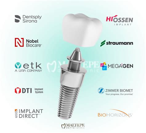 dental implant manufacturers uk