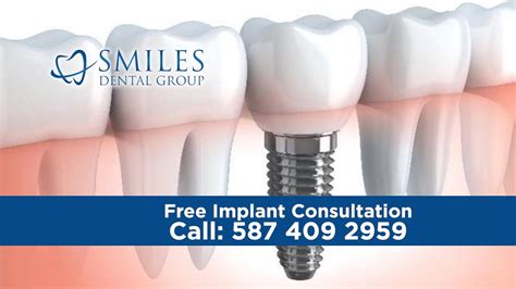 dental implants free consultation nhs