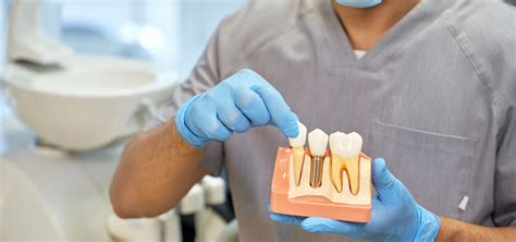 dental implants irving texas