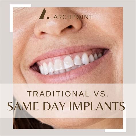 dental implants same day implants