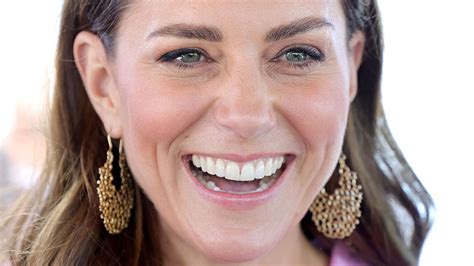 dental kate middleton smile