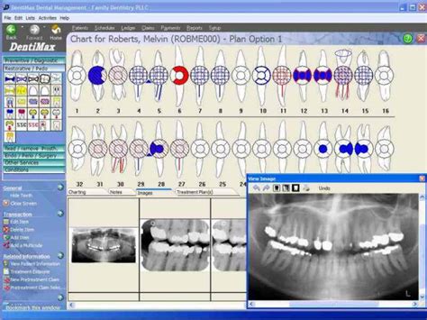 dental lab software free