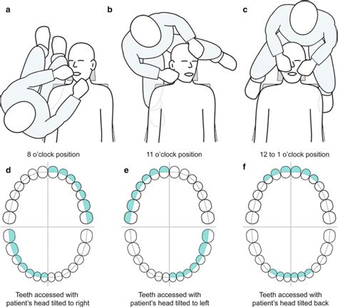 dental operator positioning guidelines