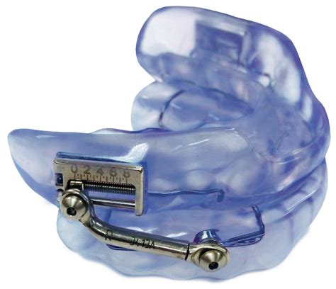 dental oral appliance for sleep apnea