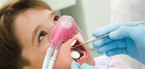 Dental Procedures With Nitrous Oxide