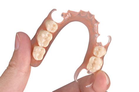 Dental Removable Partial Denture