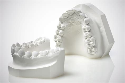 Dental Stone Model