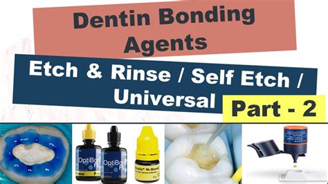 Dentin Bonding Etching