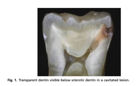 Dentin Is Found In The Quizlet