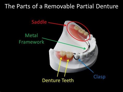 Denture Parts
