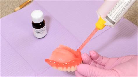 Denture Relining Procedure