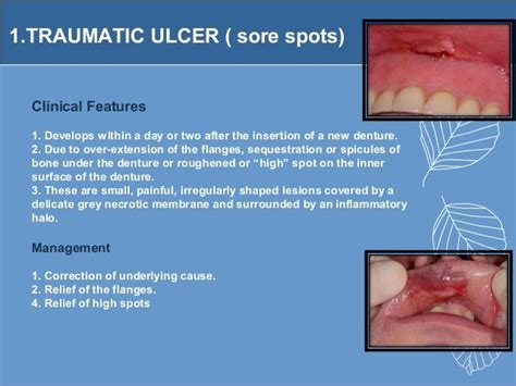 Denture Ulcerative Lesions