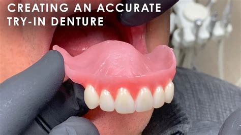 Denture Wax Try In Code