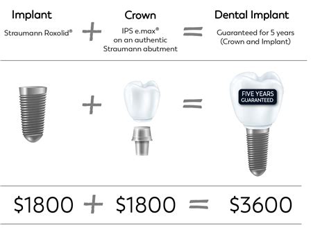 Denver Dental Implants Dental implants, Dental, Plastic surgery