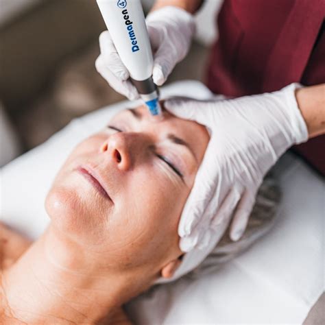 Derma Needling Creating Microchannels