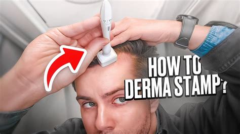 Unlock Radiant Skin: Unveiling the Transformative Power of Derma Stamping