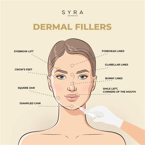 Dermal Fillers