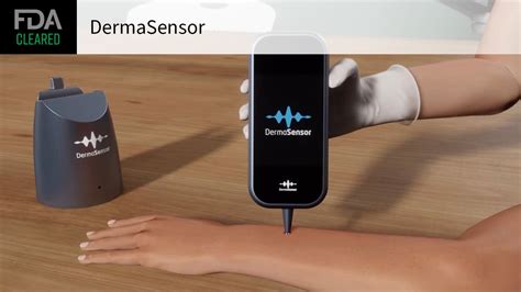 Dermasensor Fda