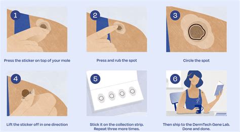 dermtech melanoma test review