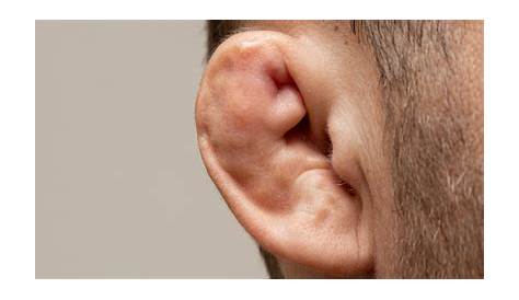 Study Medical Photos: External Ear Injuries - Brief Description With