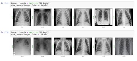Detecting Covid 19 With Chest X Ray Using Pytorch