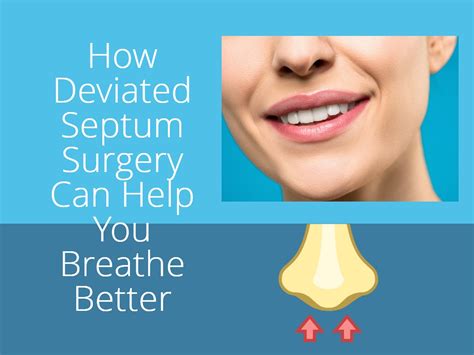 Deviated Septum Surgery Cost With Insurance In 2023