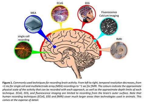 Device Measuring Electrical Activity In The Brain