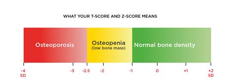 Dexa Bone Density Z Score