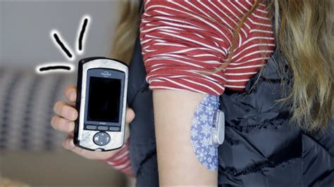 dexcom g6 with insulin pump