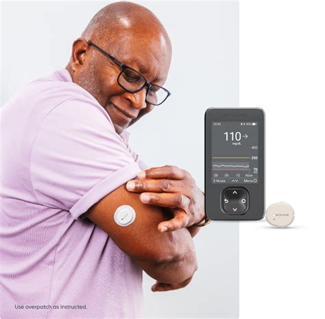 dexcom g7 comes off early